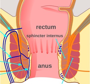 Anal Fistula Surgery Sydney Surgeon Fissure